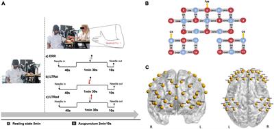 The regulations on cortical activation and functional connectivity of the dorsolateral prefrontal cortex-primary somatosensory cortex elicited by acupuncture with reinforcing-reducing manipulation